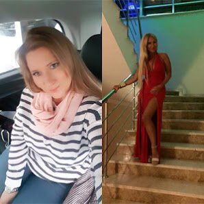 Gastric Sleeve Turkey