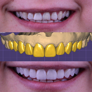 Dentium Selçuklu - Konya, Diş Hekimi, İmplant, Zirkonyum, Gülüş Tasarımı, Estetik, Ortodonti, Çocuk, Gece Açık Dişçi, Acil Sahibinin seçtikleri görseli