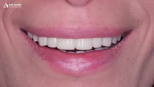 Aya Clinic Tümü görseli