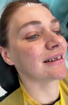 Aya Clinic Videolar görseli
